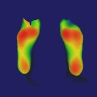 Enterprise Software for Custom Orthopedics