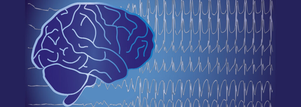 Bluetooth EEG Brainwave Device Development